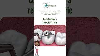 Cárie Como Funciona o Tratamento de Cáries Dentárias 🦷✨ medicina shorts 3danimation [upl. by Akenot]