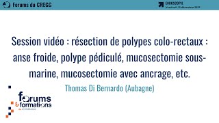 Session vidéo  résection de polypes colorectaux  Thomas Di Bernardo [upl. by Elokcin]