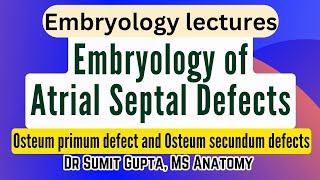 Atrial Septal Defects  Embryological basis [upl. by Ainslie450]