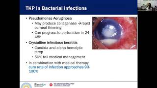 Penetrating Keratoplasty in Infectious Keratitis [upl. by Biggs]