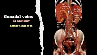 gonadal vien anatomy [upl. by Aifoz]