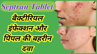 Septran DS Tablet Uses in Hindi  Septran DS  Treatment of pimples [upl. by Cornelle]