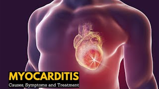 Myocarditis Causes Signs and Symptoms Diagnosis Treatment [upl. by Amek]