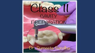 CLASS 2 CAVITY PREPARATIONOperative dentistry Cavity preparation [upl. by Louanne]