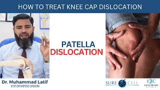 How to treat knee cap dislocation Patella Dislocation  Dr Latif [upl. by Einobe328]