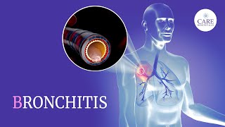 Know About Bronchitis Types Causes Symptoms Treatment And Prevention  CARE Hospitals [upl. by Jariv]