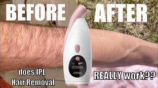 WARNING Do NOT Try IPL Hair Removal Without Watching This [upl. by Nosirrag378]