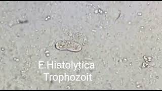 Trophozoite of Entamoeba histolytica [upl. by Gage385]