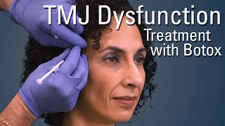 TMJ Dysfunction Treatment with Botox®  Sneak Preview [upl. by Ras30]