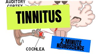 2Minute Neuroscience Tinnitus [upl. by Wightman]