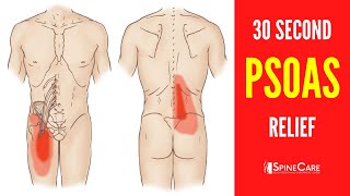 How to Fix a Tight Psoas Muscle in 30 SECONDS [upl. by Eneg348]