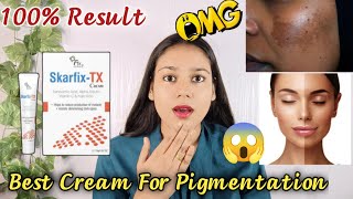 Fixderma SkarfixTx Cream ReviewBest Treatment for Melasma and HyperpigmentationSkarfix Tx cream [upl. by Idoj349]