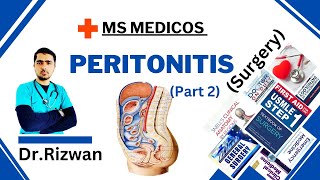 Peritonitis Part 2SurgeryMS MedicosDr RizwanUrdu Hindi Easy Explanations [upl. by Soelch]