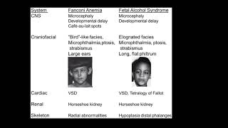 what are the differences between Fanconi anemia amp fetal alcohol syndrome radial limb anomalies [upl. by Kaja]