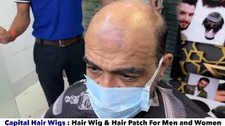 Hair wig in Noida  Hair Patch in Noida  wigs  hair wig for men  bald spot in Noida  9643765000 [upl. by Roswell]