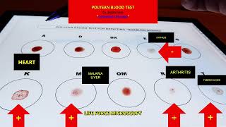 Whats Hiding in Your BLOOD TEST Results [upl. by Ika]