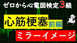 心電図【心筋梗塞】【ST上昇】【ST低下】【ミラーイメージ】ゼロから心電図検定3級 [upl. by Okoyik388]