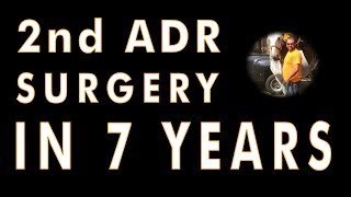 Second lumbar ADR surgery 7 years later Artificial Disc Replacement by ENANDE and Dr RitterLang [upl. by Ainoval]