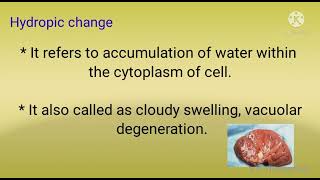 Hydropic change pathology  morphology of reversible cell injury part1 [upl. by Denison]