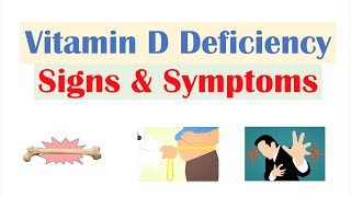 Vitamin D Deficiency Signs amp Symptoms ex Fatigue Diagnosis Treatment [upl. by Lenahs726]