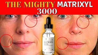 Matrixyl 3000  What is it for and What does matrixyl 3000 do for skin [upl. by Eylk741]