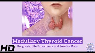 Navigating Medullary Thyroid Cancer Prognosis Unveiled [upl. by Seel890]