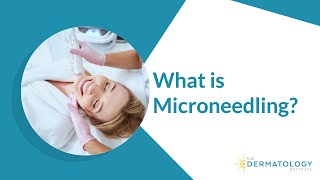 What is Microneedling  Microneedling Treatment [upl. by Aciraa312]