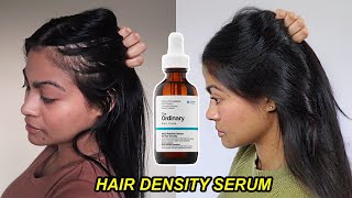 I tried The Ordinary Hair Density Serum for 1 YEAR amp THIS HAPPENED  Before and after results [upl. by Rosemary435]