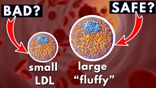 LDL size and Heart Disease small dense vs large quotfluffyquot  Dr William Cromwell [upl. by Neda423]