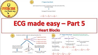 ECG made easyPart 5Heart blocks [upl. by Starbuck]