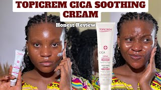 ALL YOU NEED TO KNOW ABOUT THE TOPICREM CICA SOOTHING CREAM  SKIN SENSITIVITY [upl. by Aynodal362]