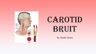 Carotid bruit  causes pathophysiology sign value [upl. by Yeknarf]