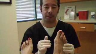 Bunions by Dr Leo Krawetz Understanding Bunions [upl. by Aramanta636]