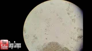 Trichomonas hominis  Coproanalisis [upl. by Yuk49]