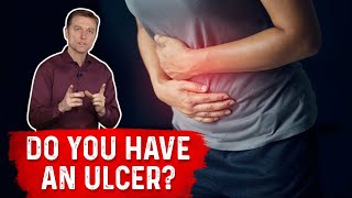 Understanding Ulcers How Do You Know If You Have One – Dr Berg [upl. by Anaj2]