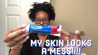 Skin Vlog I have a Perioral Dermatitis and Acne I was Prescribed Doxycycline amp Metronidazole Cream [upl. by Fredette461]