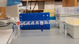 Denaturing protein samples for SDSPAGE or western blotting [upl. by Salkcin]