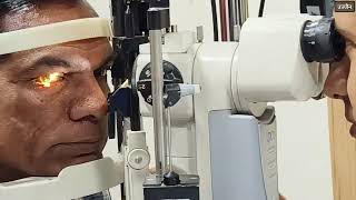 Pterygium treatment in ujjain  नाखूना का ईलाज उज्जैन मे  Eye Hospital in Ujjain  Dr Saurabh Jain [upl. by Inaj]