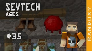 SevTech Ages Minecraft  Ep35  Coagulated Blood and Boots of Escaping “Wild Dog Pelt Boots” [upl. by Anisah]