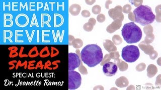 Hemepath amp Hematology Board Review Peripheral Blood Smears with Dr Jeanette Ramos [upl. by Nidraj]