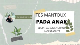 PENGALAMAN TES MANTOUX PADA ANAK [upl. by Noak]