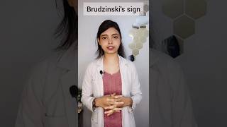 Brudzinskis sign physiotherapy neurophysiotherapy youtube youtubeshorts ytshortsindia [upl. by Odnamla]