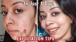 5 Exfoliation Tips for Clear Skin amp Glow How to exfoliate with Chemical Peels exfoliators [upl. by Nalyak902]