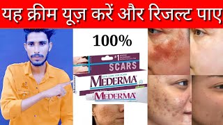 mederma cream use review in Hindimederma advanced scar gel review 2024mederma cream [upl. by Nolubez]