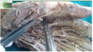 Thenar and Hypothenar Muscles and Lumbricals of Hand  Dr Nishigandha Sadamate [upl. by Quenna]