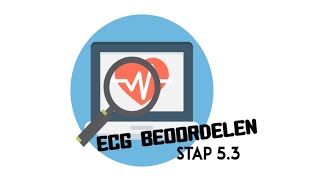 ECG beoordelen  stap 53 QRSmorfologiePathologisch Q amp Hypertrofie [upl. by Osicran952]