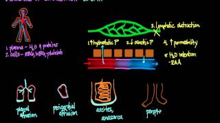 Disorders of Circulation Edema [upl. by Ancelin]