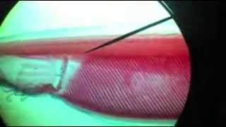 Anatomy of Amphioxus تشريح السهيم  YouTube [upl. by Heise]