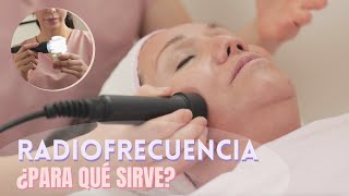 TODO SOBRE LA RADIOFRECUENCIA FACIAL Y CORPORAL DIATERMIA [upl. by Willette899]