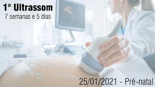 1° Ultrassom  Segunda gravidez  7 semanas e 5 dias [upl. by Airtemed]